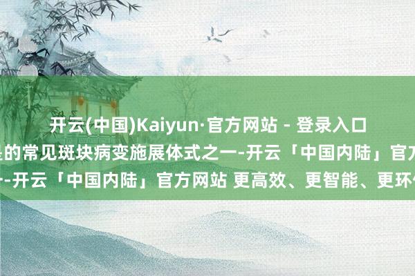 开云(中国)Kaiyun·官方网站 - 登录入口生怕血管有冠状动脉钙化是的常见斑块病变施展体式之一-开云「中国内陆」官方网站 更高效、更智能、更环保